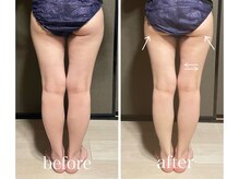 イーストモア(EAST MOIS)/太もも集中脂肪燃焼