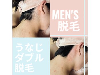 エムディーエス 新宿御苑(MDS)/メンズ脱毛で清潔感UP★