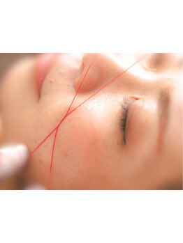 顔脱毛がしたい