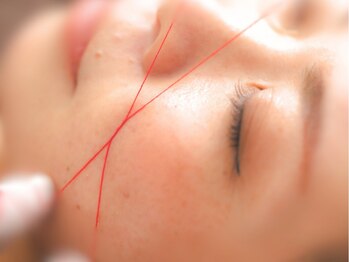 ビビ(BiBi)の写真/『糸だけで…』話題のスレッディングで韓国式つるん肌に♪肌に優しく産毛と角質を絡めとる韓国式の糸脱毛