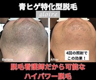 グロワール(gloire)