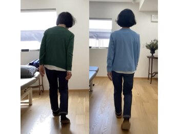 ランドル(rendre)/背骨の弯曲、姿勢改善、腰痛軽減