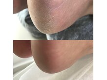 ネイルズ ジュエル(Nails Jewel)の雰囲気（スパルーチェのケアでワンランク上のふわふわモチモチに！）