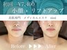 【小顔＆リフトアップ】持続力に定評あり蓄熱式超音波  ¥12,500→¥7,400