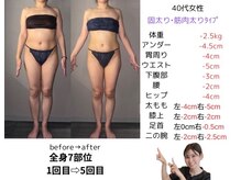 サロンスペースの雰囲気（【痩身】ハイパーナイフEX 全身7部位　1→5回 ビフォーアフター）