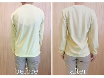 カイロライン松本整体院/姿勢改善×背中はり/BeforeAfter