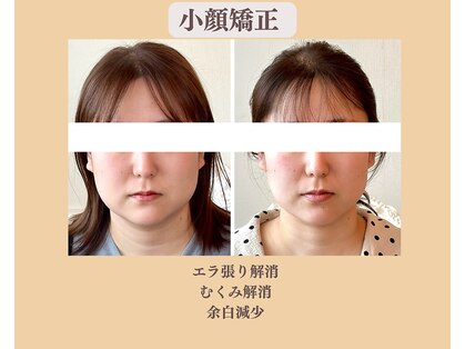 リフェイスフサエ(ReFace Fusae)の写真