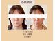 リフェイスフサエ(ReFace Fusae)の写真