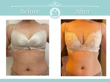 美人バスト 浜松店/◇ バストアップ &nbsp;BeforeAfter◇
