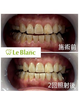 ルブラン 奈良店(Le Blanc)/お試しクーポンでお得に！！