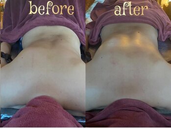 温和活 ロータス(温和活Lotus蓮:)/オイルリンパマッサージ施術変化