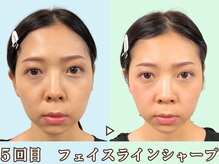 ナチュラルビューティーフェイス 横浜(NBF)/整うと印象が変わる/横浜駅