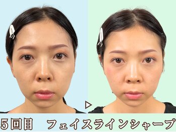 ナチュラルビューティーフェイス 横浜(NBF)/整うと印象が変わる/横浜駅