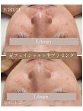 リブラン(Libran)/目元のハリアップ★