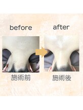 アンジェム(Angem)/自分で見えないけど気になってた