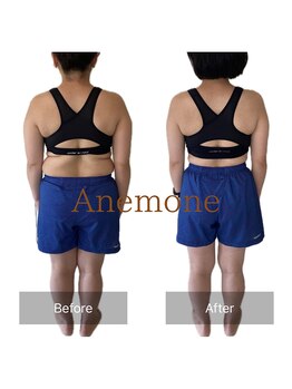 アネモネ/ダイエット/痩身/耳つぼ/腸活