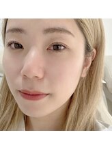 プール エドボリ(POOL EDOBORI)/◇ラッシュリフト/まつ毛パーマ