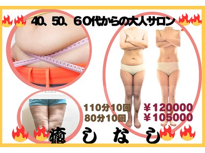 フレクシーの写真