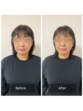 チル(Chill.)/美容整体×小顔整顔で効果長持ち