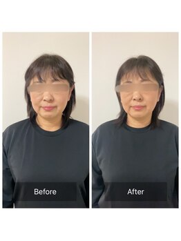 チル(Chill.)/美容整体×小顔整顔で効果長持ち