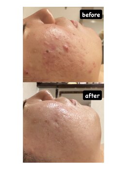 ディサイドロー(DECIDE L.A.W)/BeforeAfter