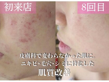 アンドエピ(&epi)の写真