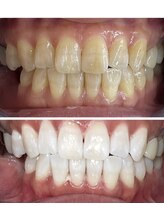 エマ(EMMA)&nbsp;スタッフ 