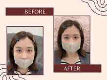 ナキ 富山店(Naki)/眉毛施術例 (眉毛Before.After)