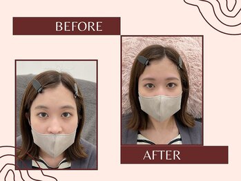 ナキ 富山店(Naki)/眉毛施術例 (眉毛Before.After)