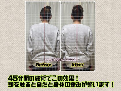 エビアス(Ebias)の写真