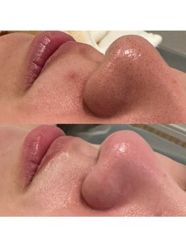 ミューズ(MUSE)/エクストラクション