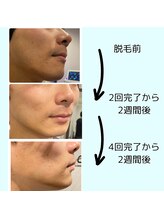 ワイズサロン(Y's salon)/4回での結果サイドから！