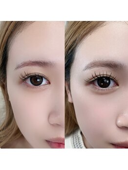 ルチア(LUCIA)/アンドヘルシー