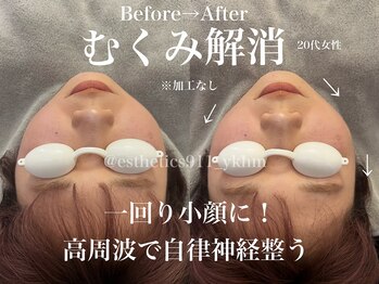 エステティックス ナインワンワン 横浜(Esthetics911) /むくみ改善、自律神経リラックス