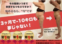 ヴィアス(VIAS)