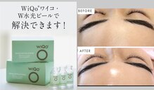 ジュエルビューティー(Jewel Beauty)