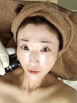 アルページュ(Arpege)の写真/セルケア×レモンボトルで最強小顔♪弛みケア/ブルドッグ/緩みライン/ポニョ/目の下のダルんを撃退！