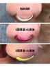 【SONRISA指名限定】初！巻き爪ケアカラージェル　12000円→10500円