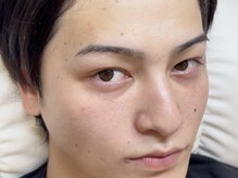 ジレース オモテサンドウ(JILEYES omotesando)/メンズ眉毛パーマ/まつげパーマ