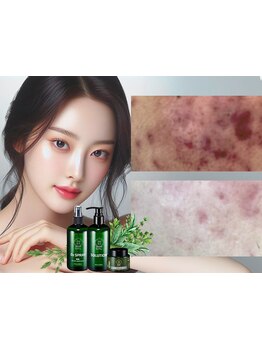 ハリツヤをUPしたい