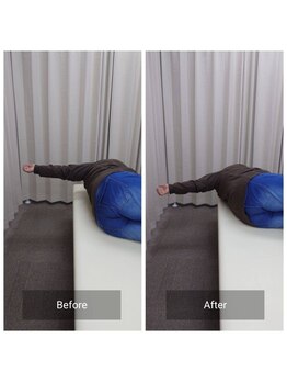 ナオル整体 札幌白石院(NAORU整体)/巻き肩チェック｜肩の開き改善