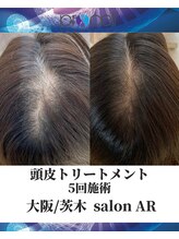 メンズサロンアール(AR)/プロセルセラピーズ