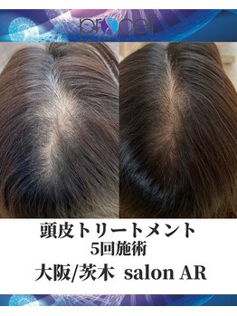 メンズサロンアール(AR)/プロセルセラピーズ
