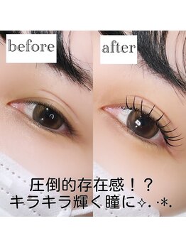 アルテ 名古屋栄店(arte)/瞳に光が入って明るく