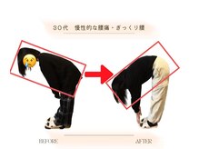 ストレッチ 整体 ホープ(HOPE)/滋賀では珍しいストレッチ整体