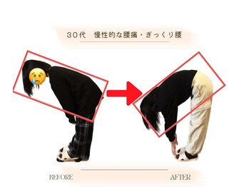 ストレッチ 整体 ホープ(HOPE)/滋賀では珍しいストレッチ整体