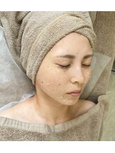 ミセル(MISEL)/人気No.1韓国式ピーリング