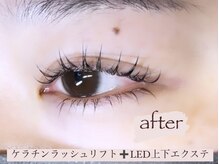 イクアイラッシュ(iku eyelash)/LED上下エクステ+まつげパーマ