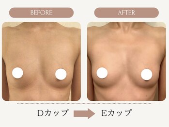 ウェルバスト(Well Bust)/【バストアップ例】D→Eカップ