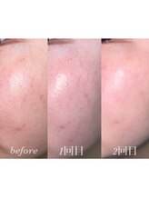 テルヒブール(terhibur)/